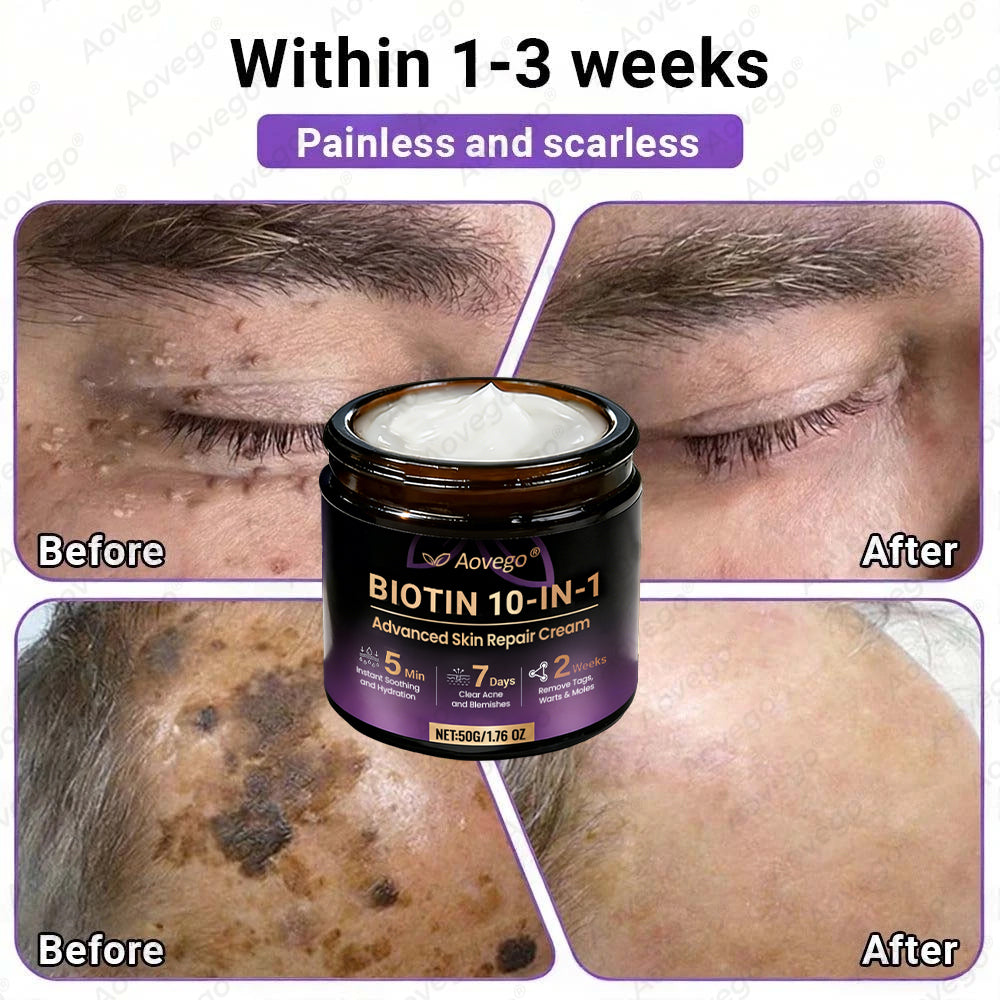 J🌻Aovego® Biotin 10-in-1 Skin Repair Cream - Advanced Formula for Clear Skin ✨