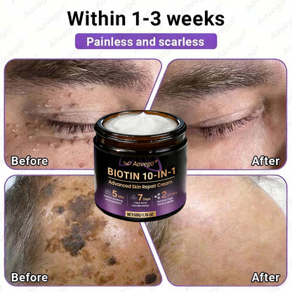 J🌻Aovego® Biotin 10-in-1 Skin Repair Cream - Advanced Formula for Clear Skin ✨