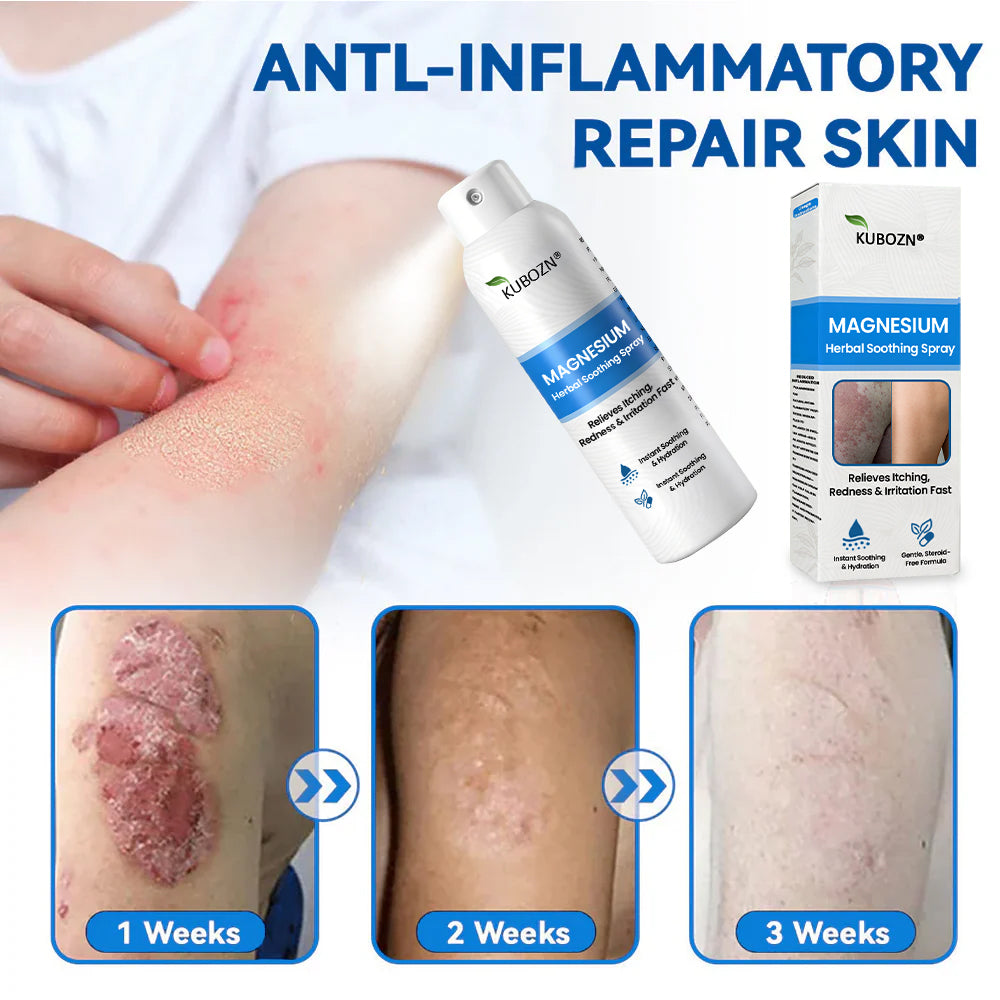 J✅ Official Store:KUBOZN® Magnesium Herbal Spray – Fast Relief for Psoriasis & Eczema | No-Rub, Steroid-Free