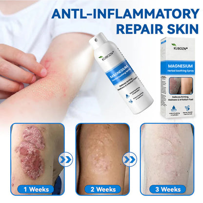J✅ Official Store:KUBOZN® Magnesium Herbal Spray – Fast Relief for Psoriasis & Eczema | No-Rub, Steroid-Free