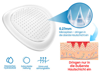 🧬KUBOZN® Mikronadel-Pflaster gegen Gelenkschmerzen & Entzündungen