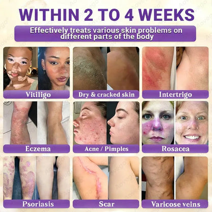 J🌻Aovego® Biotin 10-in-1 Skin Repair Cream - Advanced Formula for Clear Skin ✨