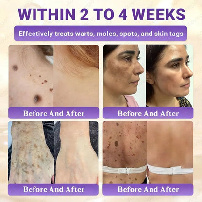 J🌻Aovego® Biotin 10-in-1 Skin Repair Cream - Advanced Formula for Clear Skin ✨