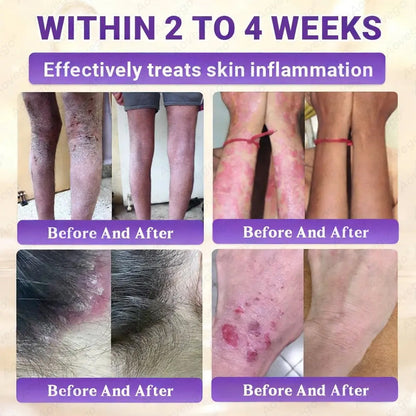 J🌻Aovego® Biotin 10-in-1 Skin Repair Cream - Advanced Formula for Clear Skin ✨