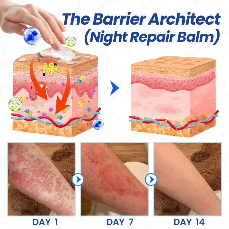 🇭✨KUBOZN® Psoriasis Day & Night Repair System - 100% Steroid-Free Relief Duo for Plaques, Scaling & Itch
