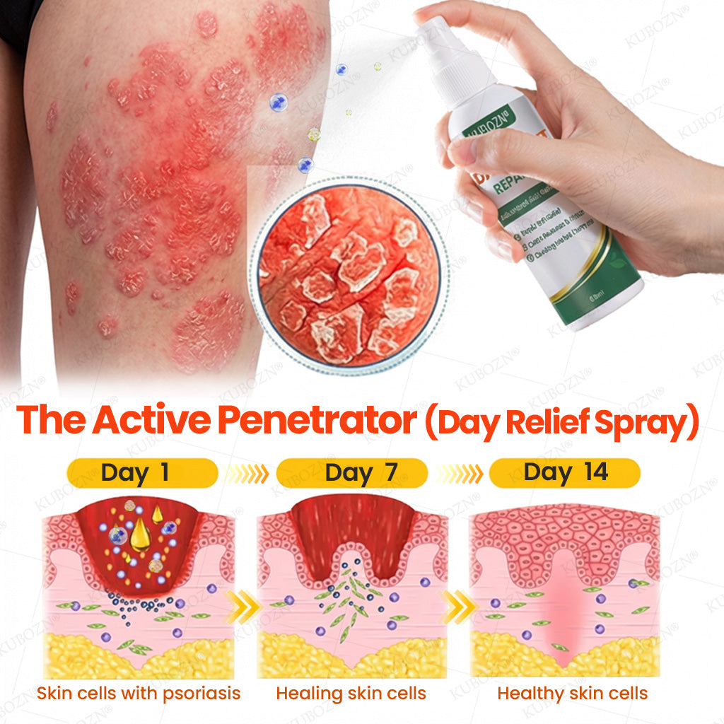 🇭✨KUBOZN® Psoriasis Day & Night Repair System - 100% Steroid-Free Relief Duo for Plaques, Scaling & Itch