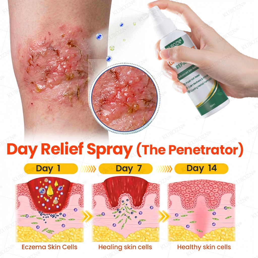 🇭✨KUBOZN® Eczema Day & Night Repair System - 100% Steroid-Free Relief Duo for Intense Itch, Redness & Broken Skin