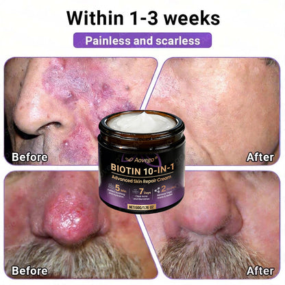 J🌻Aovego® Biotin 10-in-1 Skin Repair Cream - Advanced Formula for Clear Skin ✨
