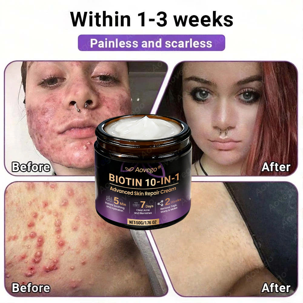 J🌻Aovego® Biotin 10-in-1 Skin Repair Cream - Advanced Formula for Clear Skin ✨