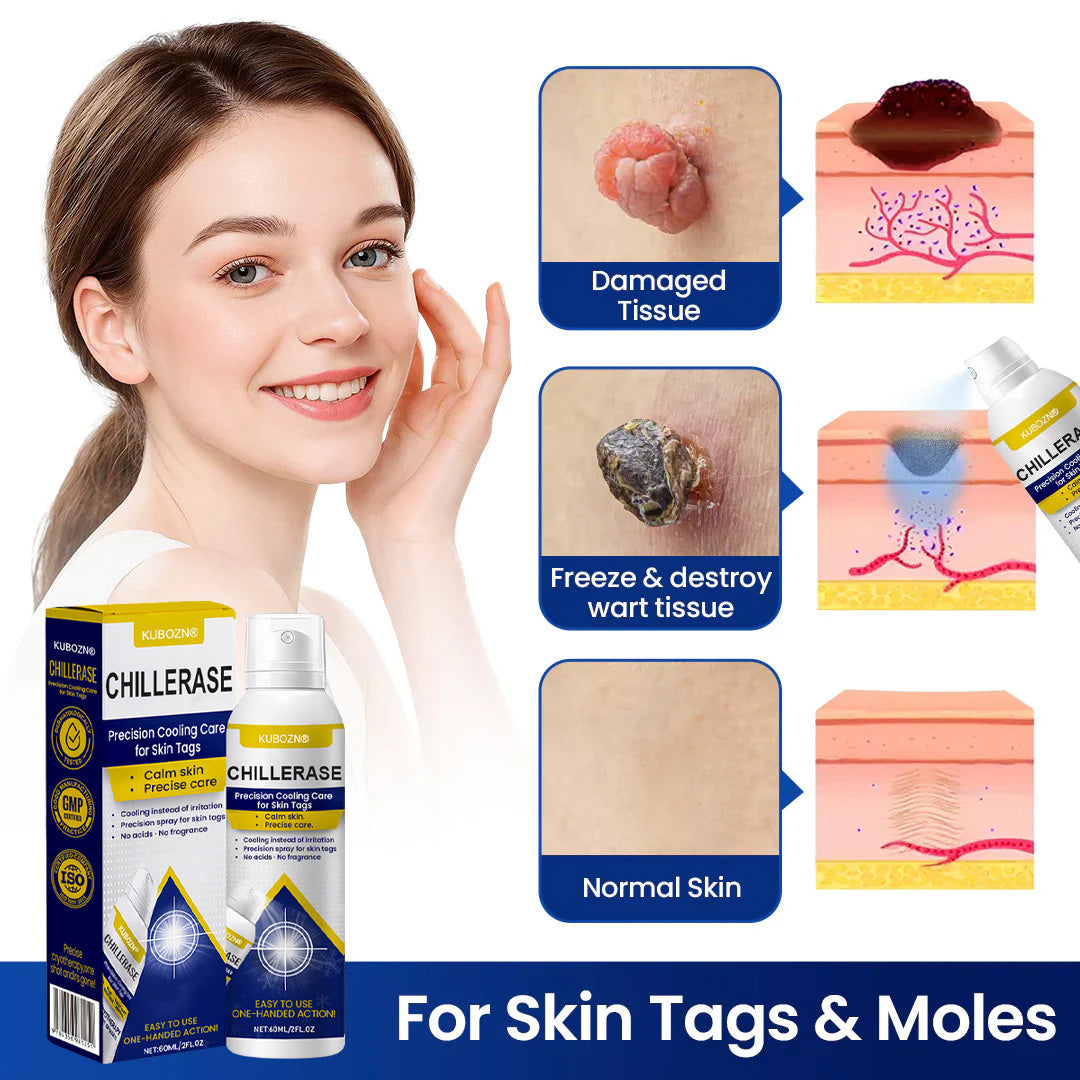🇭 KUBOZN® ChillErase Cooling Spray for Skin Tags