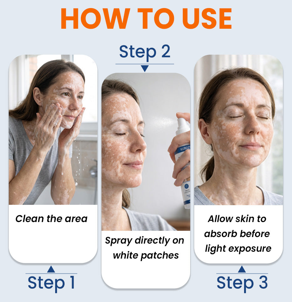 J⚡KUBOZN® Piperine Repigment Activator Spray to Reactivate Dormant Pigment Cells & Restore Natural Skin Color